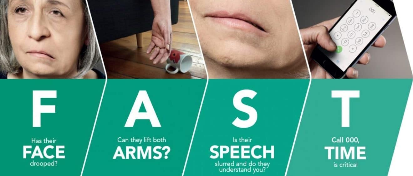 Stroke-The Different Faces • Bariboost