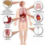 Vitamin B1 thiamine deficiency