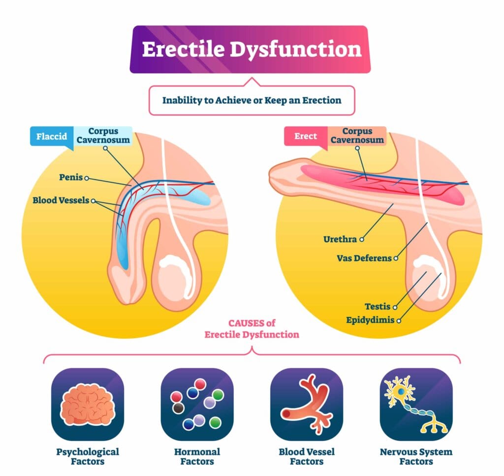 erectile dysfunction