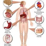 folic acid deficiency after bariatric surgery effects