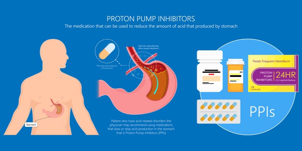 proton pump inhibitors