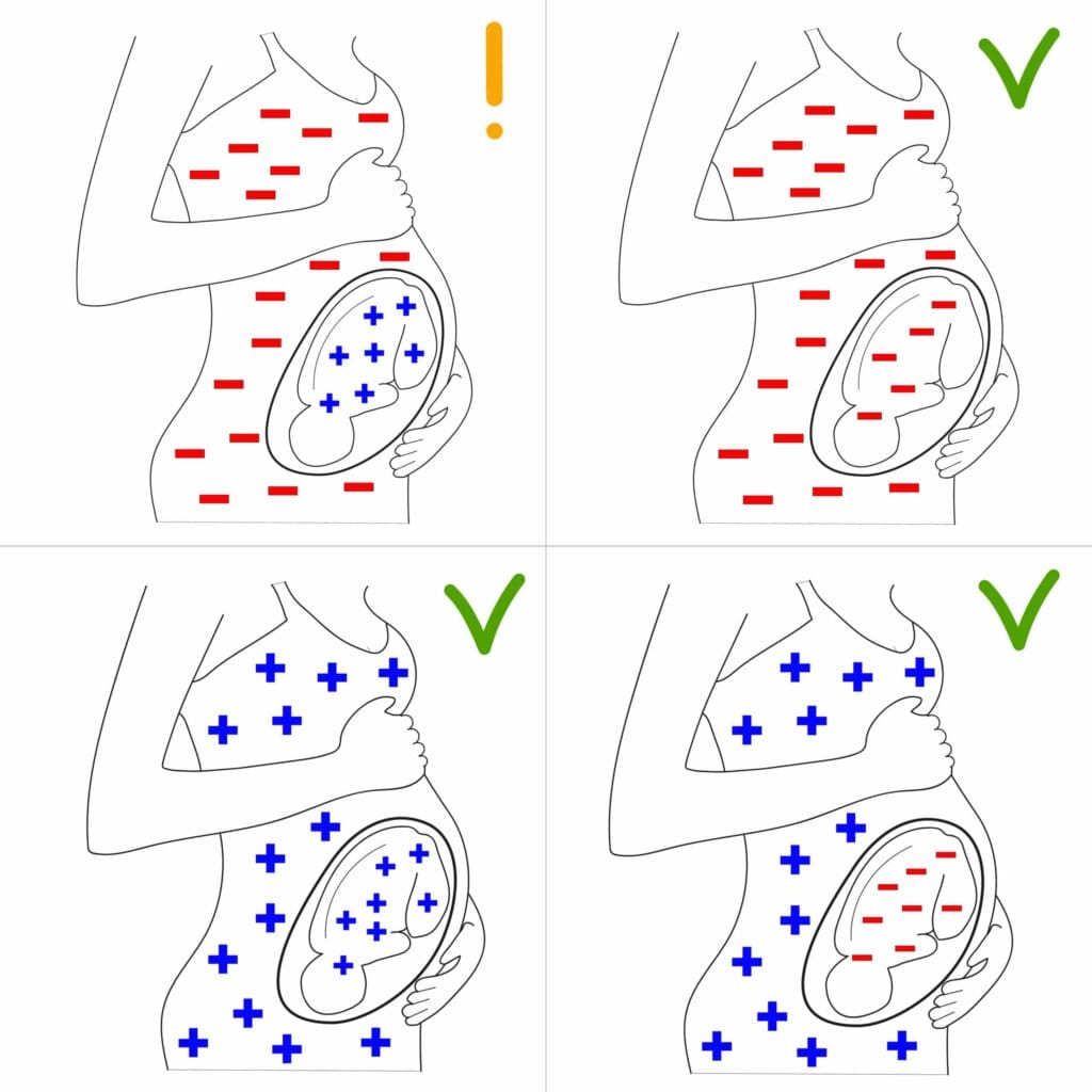 rhesus incompatibility